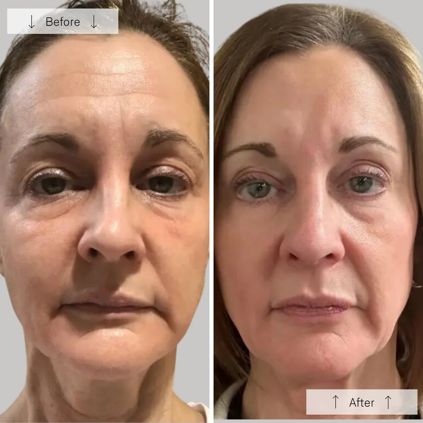 Omnilux Contour Face Near Infrared + LED