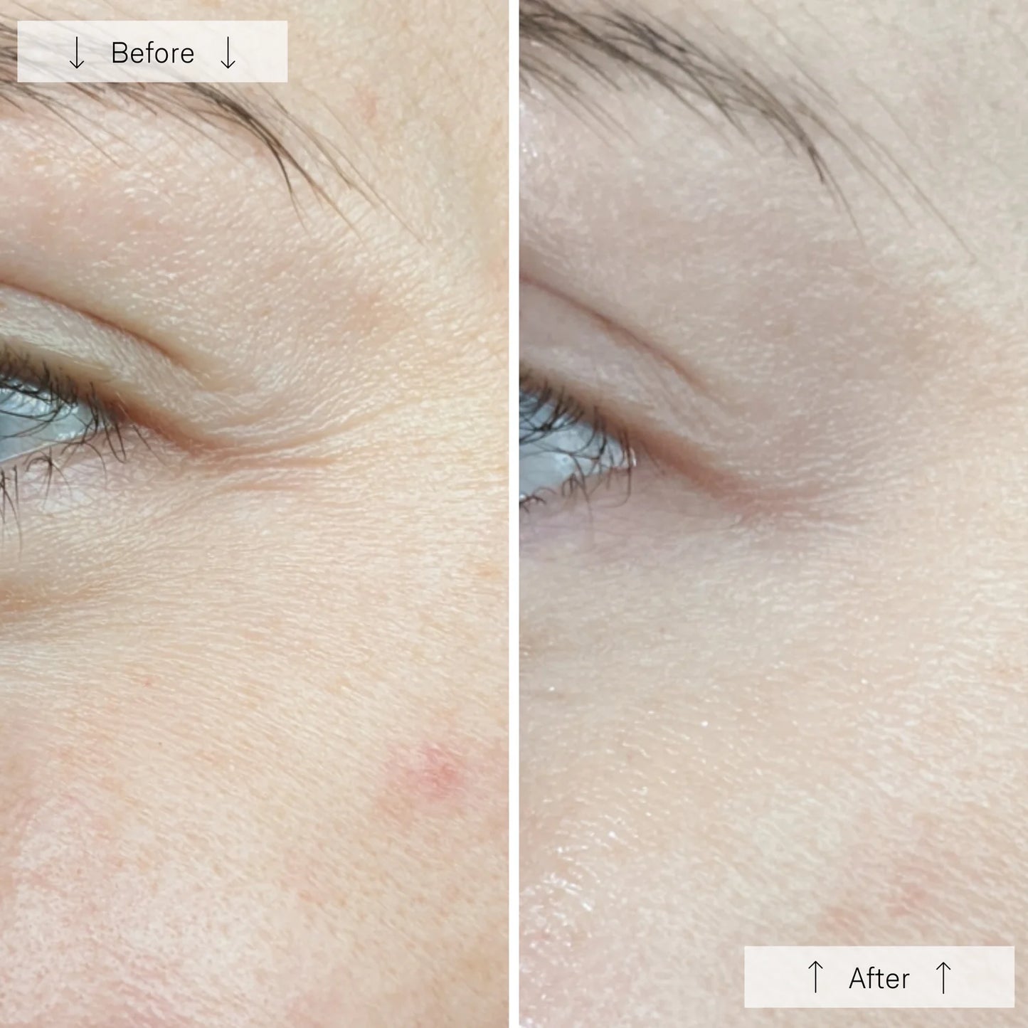 Omnilux Contour Face Near Infrared + LED