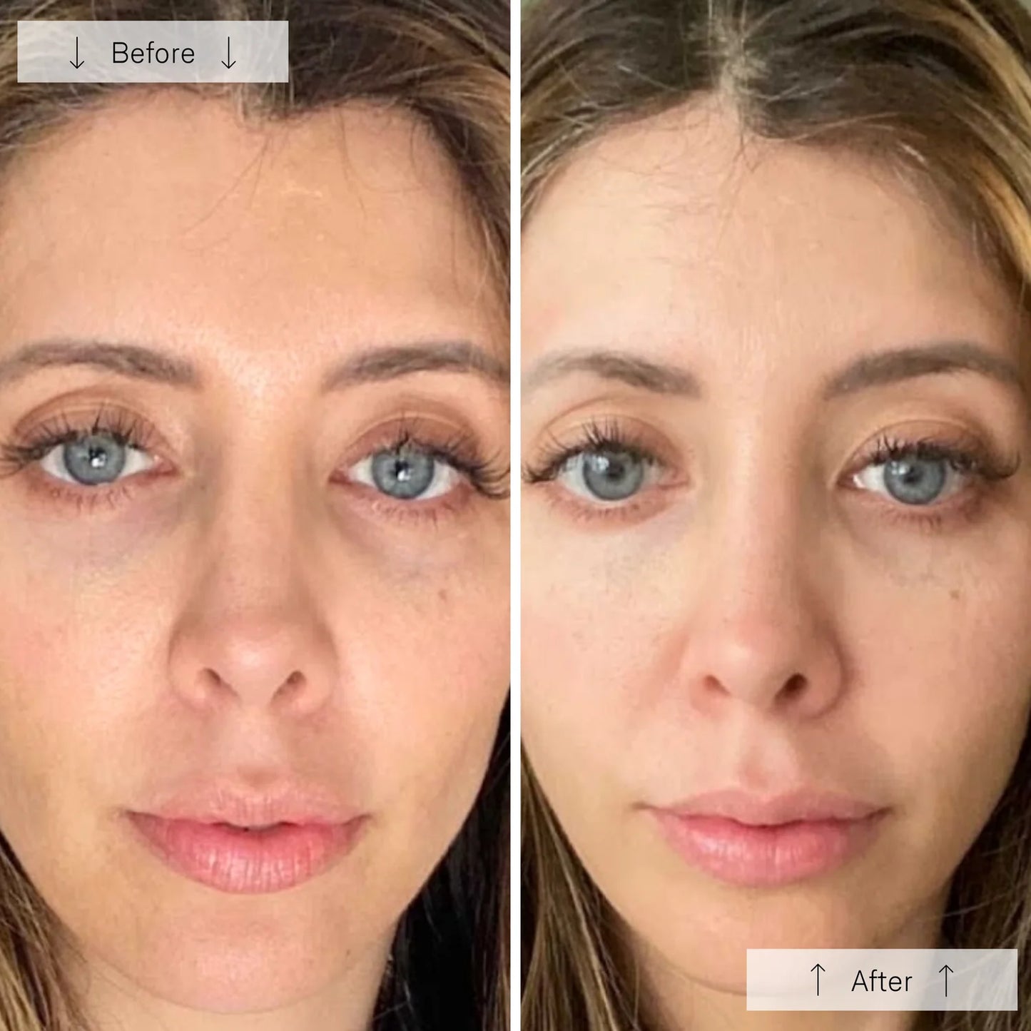 Omnilux Contour Face Near Infrared + LED