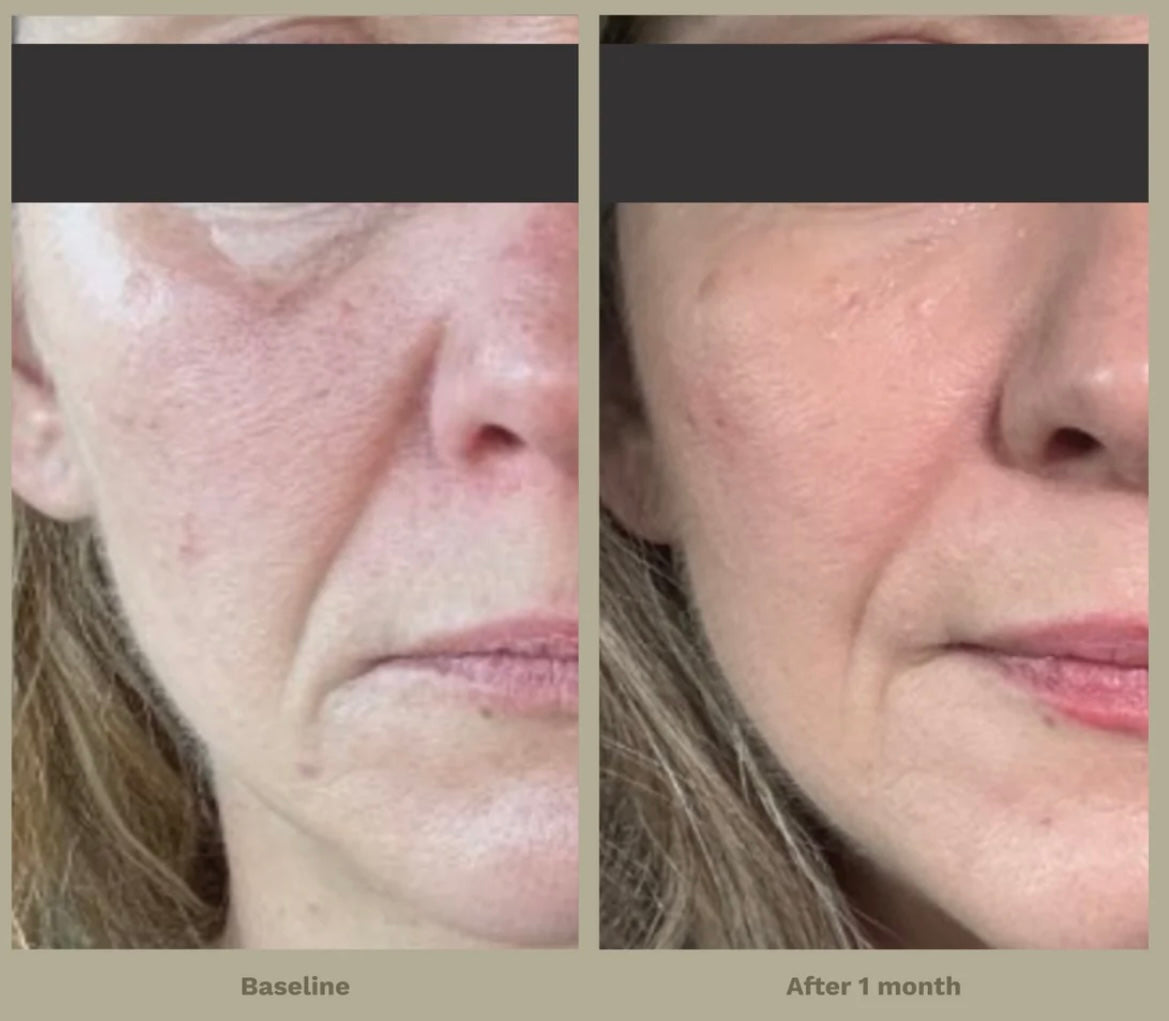 Adipeau Strong Body Gel FREE SHIPPING